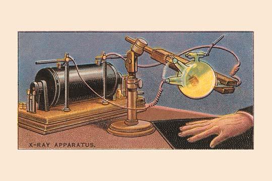 X-Ray Discovery Poster Print showcasing the revolutionary medical imaging technique