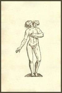 Monstrum Hermaphroditicum Biceps Poster Print from Ulisse Aldrovandi's Monstrorum Historia