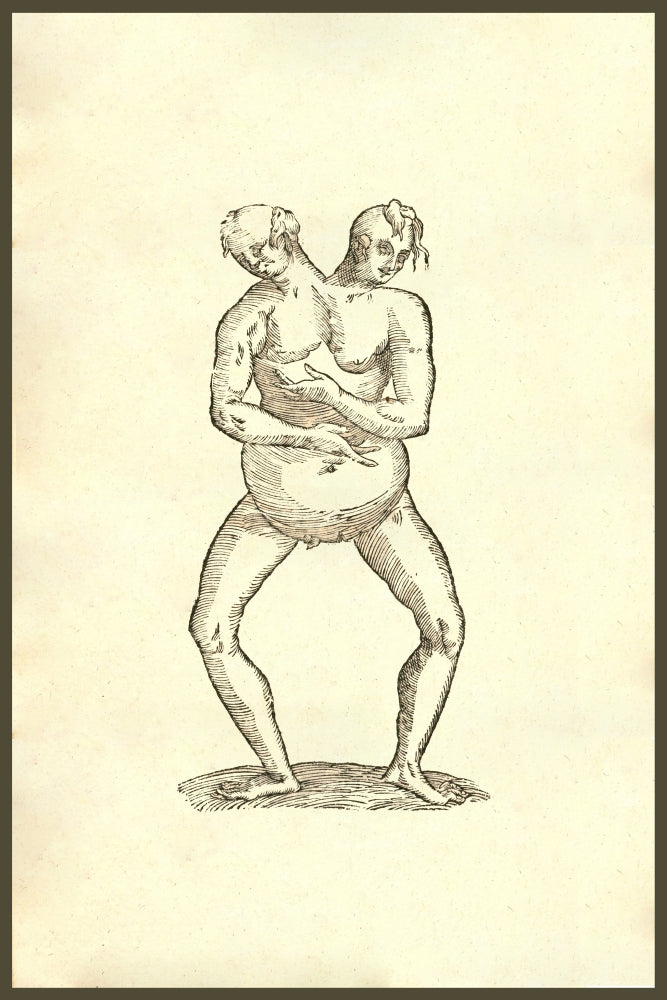Monstrum Hermaphroditicum Biceps Aliud Poster Print by Ulisse Aldrovandi
