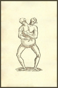 Monstrum Hermaphroditicum Biceps Aliud Poster Print by Ulisse Aldrovandi