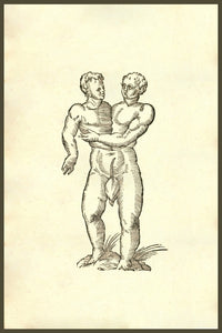 Infans Biceps Obscaeno Membro Siamese Twins Poster Print by Ulisse Aldrovandi