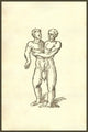 Infans Biceps Obscaeno Membro Siamese Twins Poster Print by Ulisse Aldrovandi
