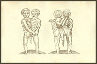 Monstrum Biceps Caudatum Prone & Supine Pictum Poster Print by Ulisse Aldrovandi