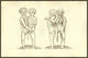 Monstrum Biceps Caudatum Prone & Supine Pictum Poster Print by Ulisse Aldrovandi