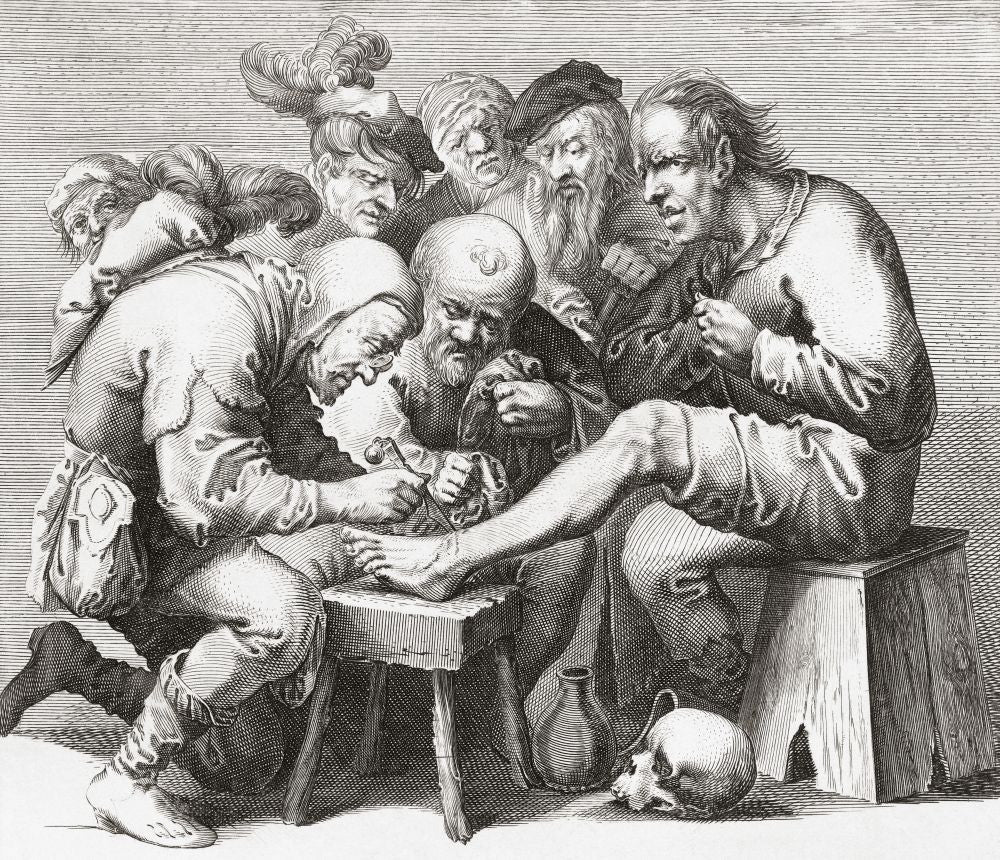 17th Century Surgeon Performing Foot Surgery Art Print by Ken Welsh