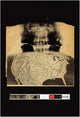 Radiohead Amnesiac Poster Print - 24x36