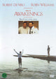 Awakenings Movie Poster Print showcasing vibrant imagery.