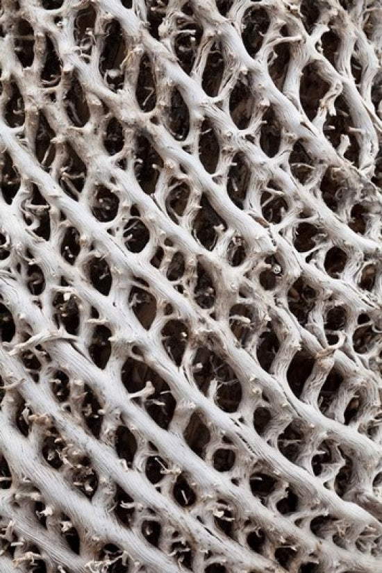 Lattice Pattern in Giant Loebelia poster print by Martin Zwick showcasing vibrant nature in Bale Mountains, Ethiopia.