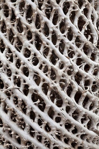 Lattice Pattern in Giant Loebelia poster print by Martin Zwick showcasing vibrant nature in Bale Mountains, Ethiopia.
