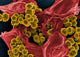Scanning electron micrograph of Staphylococcus and a dead human neutrophil.