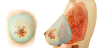 Medical illustration of female breast showing front and side views.