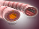 Trachea Cross-Section Poster Print showing normal and asthmatic bronchiole comparison.