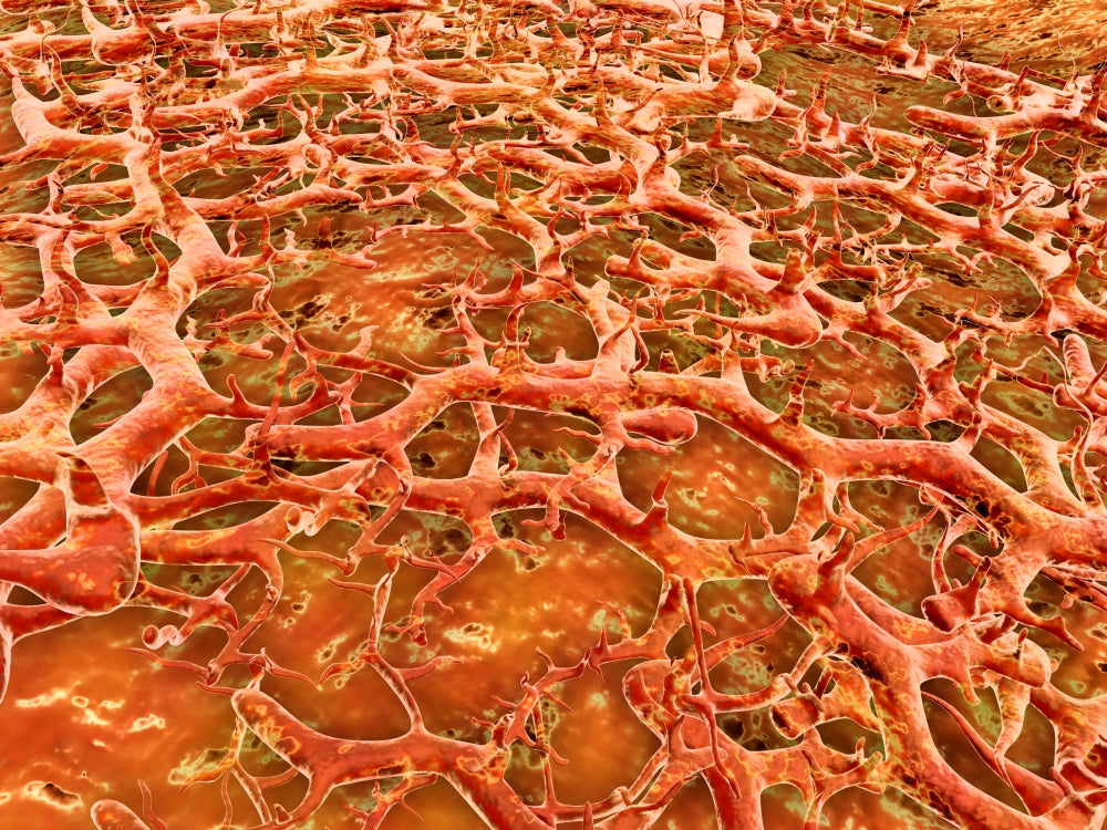 Close-up view of athlete's foot fungus - tinea pedis poster print.