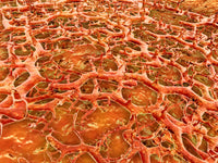 Close-up view of athlete's foot fungus - tinea pedis poster print.