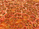 Close-up view of athlete's foot fungus - tinea pedis poster print.