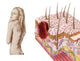 Atypical growth on skin illustration poster print for health awareness.
