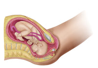 Fetal Development Illustration Poster Print showing delivery in the womb.