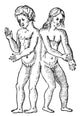 Hermaphroditic Conjoined Twins 16th Century Poster Print by Science Source