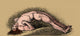 Opisthotonos Poster Print illustrating human anatomy