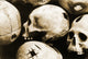 Skulls Showing Trepanation Poster Print by Science Source, educational artwork