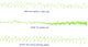 EEG of Epileptic Seizures Poster Print showcasing brain waveforms