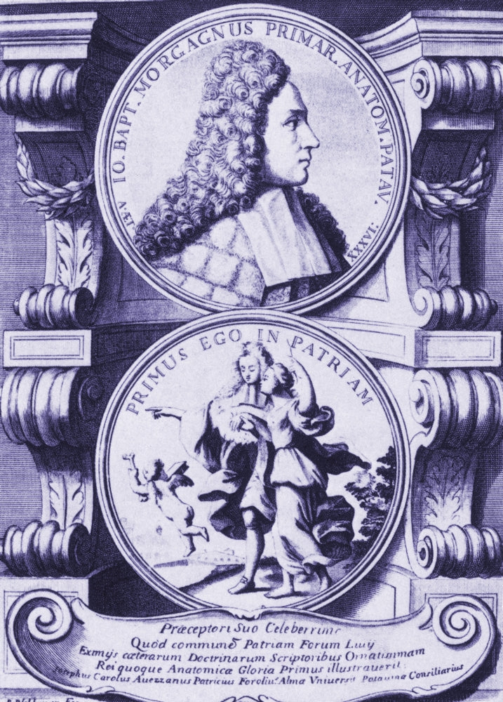 Giovanni Morgagni Anatomical Poster Print showcasing anatomical details.