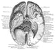 Undersurface of the Brain Poster Print showcasing detailed brain anatomy.