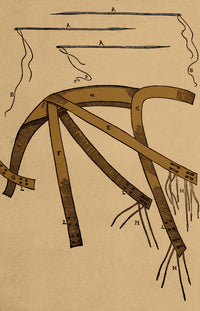 Tagliacozzi Rhinoplasty Method Equipment Poster Print showcasing historical medical techniques.