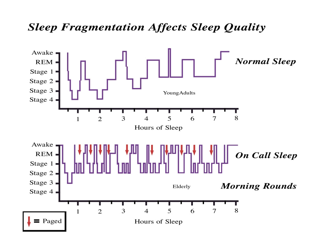 Sleep Fragmentation Affects Sleep Quality Graph Poster Print by Gwen Shockey