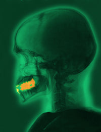 Skull X-Ray with Dental Fillings Poster Print showcasing detailed anatomy.