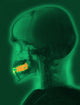 Skull X-Ray with Dental Fillings Poster Print showcasing detailed anatomy.