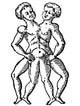 Conjoined Twins 16th Century Poster Print by Science Source