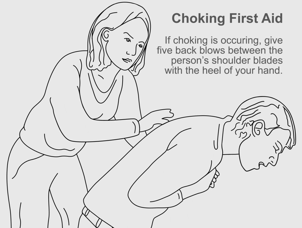 Choking First Aid Educational Poster Print by Science Source