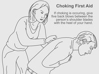 Choking First Aid Educational Poster Print by Science Source