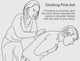 Choking First Aid Educational Poster Print by Science Source