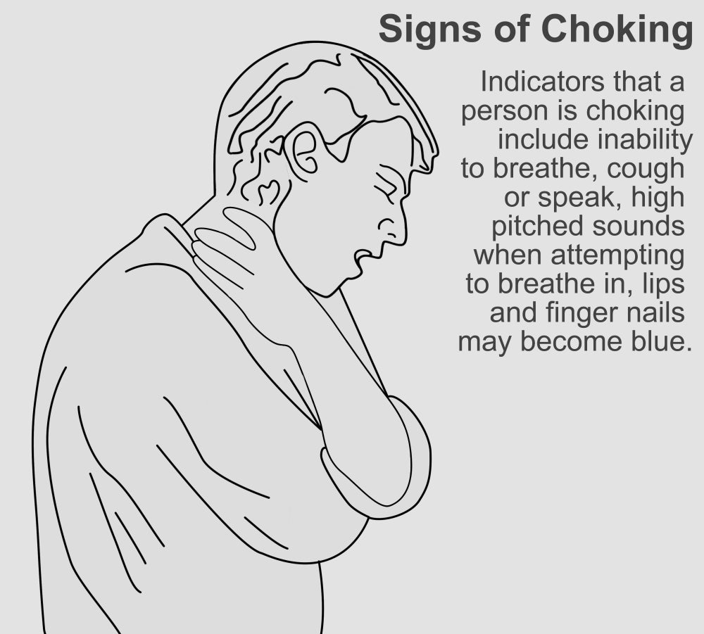 Signs of Choking Educational Poster Print by Science Source