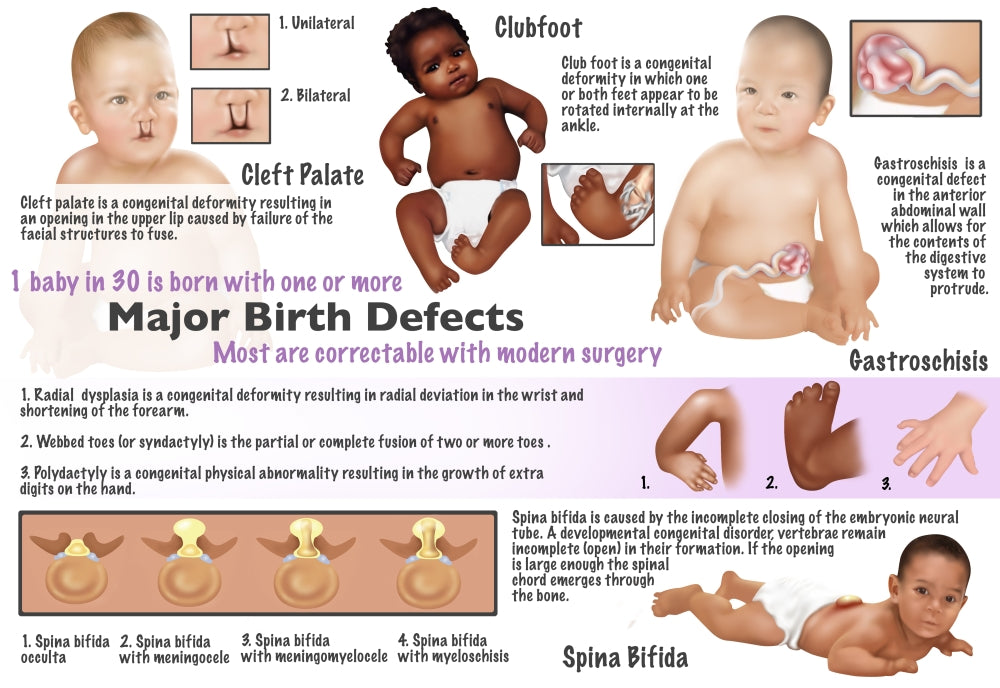 Birth defects in babies educational poster print by Gwen Shockey