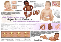 Birth defects in babies educational poster print by Gwen Shockey