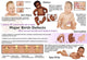 Birth defects in babies educational poster print by Gwen Shockey