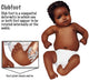 Baby with Club Foot Poster Print by Gwen Shockey - Educational Art