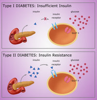 Diabetes I & II Educational Poster Print by Monica Schroeder