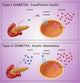 Diabetes I & II Educational Poster Print by Monica Schroeder