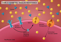Type II Diabetes Educational Poster Print by Science Source, available in multiple sizes