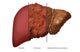 Liver Comparison Educational Poster by Monica Schroeder featuring anatomical illustrations.