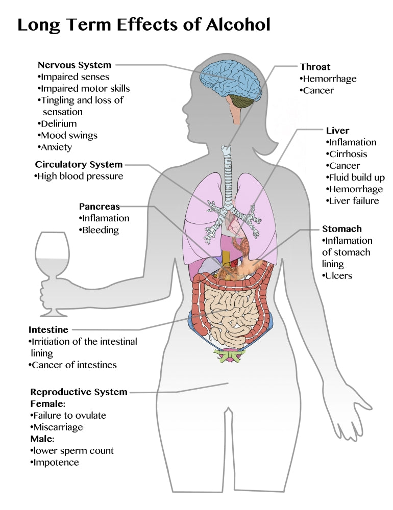 Long Term Effects of Alcohol Poster Print for health education