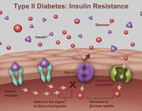 Type 2 Diabetes Awareness Poster Print by Gwen Shockey