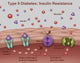 Type 2 Diabetes Awareness Poster Print by Gwen Shockey