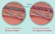 Type 1 and Type 2 Diabetes Educational Poster Print by Gwen Shockey