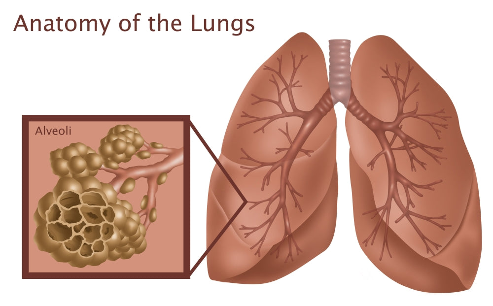 Lungs & Alveoli with Emphysema Poster Print illustrating human anatomy.