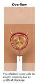 Overflow Incontinence Poster Print by Gwen Shockey, educational art for anatomy and health.